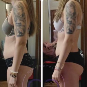 Antes y después de una clienta tras su proceso Real Balance