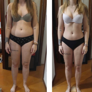 Antes y después de una clienta tras su proceso Real Balance