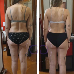 Antes y después de una clienta tras su proceso Real Balance