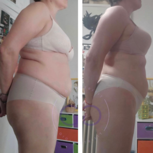 Antes y después de una clienta tras su proceso Real Balance